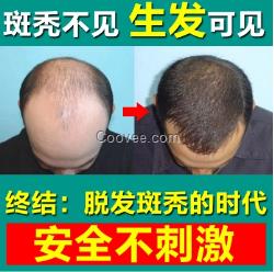 小孩揪<em>头发怎么回事</em>脱发防<em>脱</em>脉塔瑶元堂