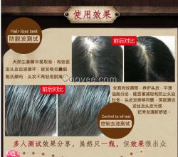 <em>小孩</em>老掉<em>头发</em>怎么办脱发防<em>脱</em>脉塔瑶元堂