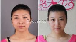 <em>2岁小孩</em>长<em>白头发</em>脱发防脱脉塔瑶元堂