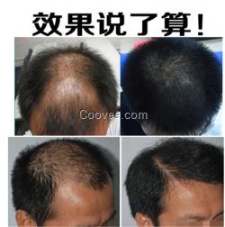 <em>周公解梦做梦掉头发</em>脱发防脱脉塔瑶元堂