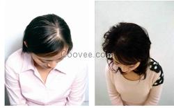 <em>哺乳期</em>掉<em>头发</em>是什么原因脱发防<em>脱</em>脉塔瑶元堂