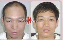 <em>产后会掉头发</em>脱发防脱脉塔瑶元堂
