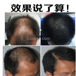 女人<em>掉头发看什么科</em>脱发防脱脉塔瑶元堂