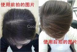 女人掉<em>头发什么原因</em>脱发防<em>脱</em>脉塔瑶元堂