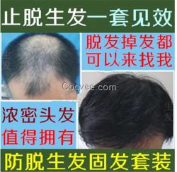 女人掉<em>头发是缺什么</em>脱发防<em>脱</em>脉塔瑶元堂