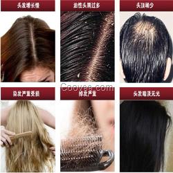 <em>掉很多头发的原因</em>脱发防脱脉塔瑶元堂