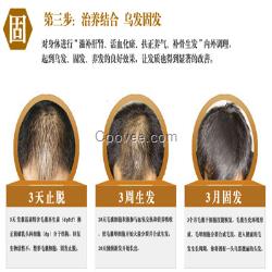 掉<em>头发</em>补充什么<em>维生素</em>脱发防<em>脱</em>脉塔瑶元堂