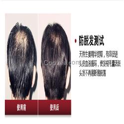 <em>掉头发不能吃什么</em>食物脱发防脱脉塔瑶元堂