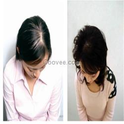 女人<em>梦见</em>掉<em>头发</em>脱发防<em>脱</em>脉塔瑶元堂