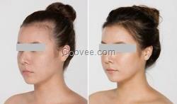 人<em>每天</em>会掉<em>多少头发</em>脱发防<em>脱</em>脉塔瑶元堂