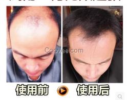 治疗<em>中年白发</em>偏方防脱止脱品牌推荐瑶元堂