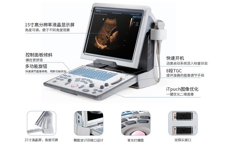 迈瑞DP-50全数字便携式超声诊断系统